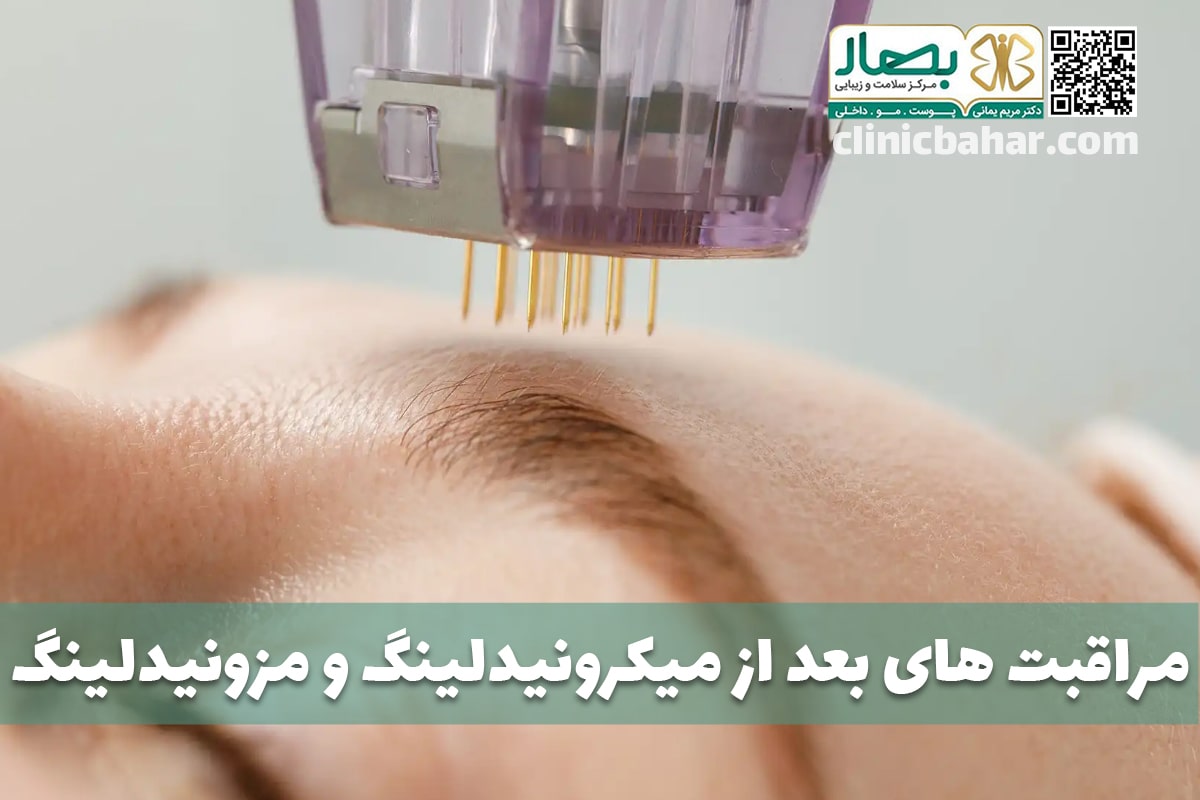 care after microneedling mesoneedeling