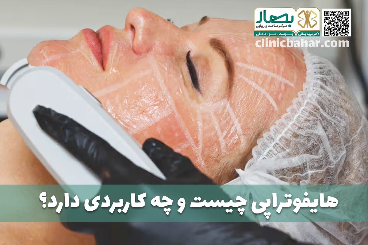 هایفوتراپی
