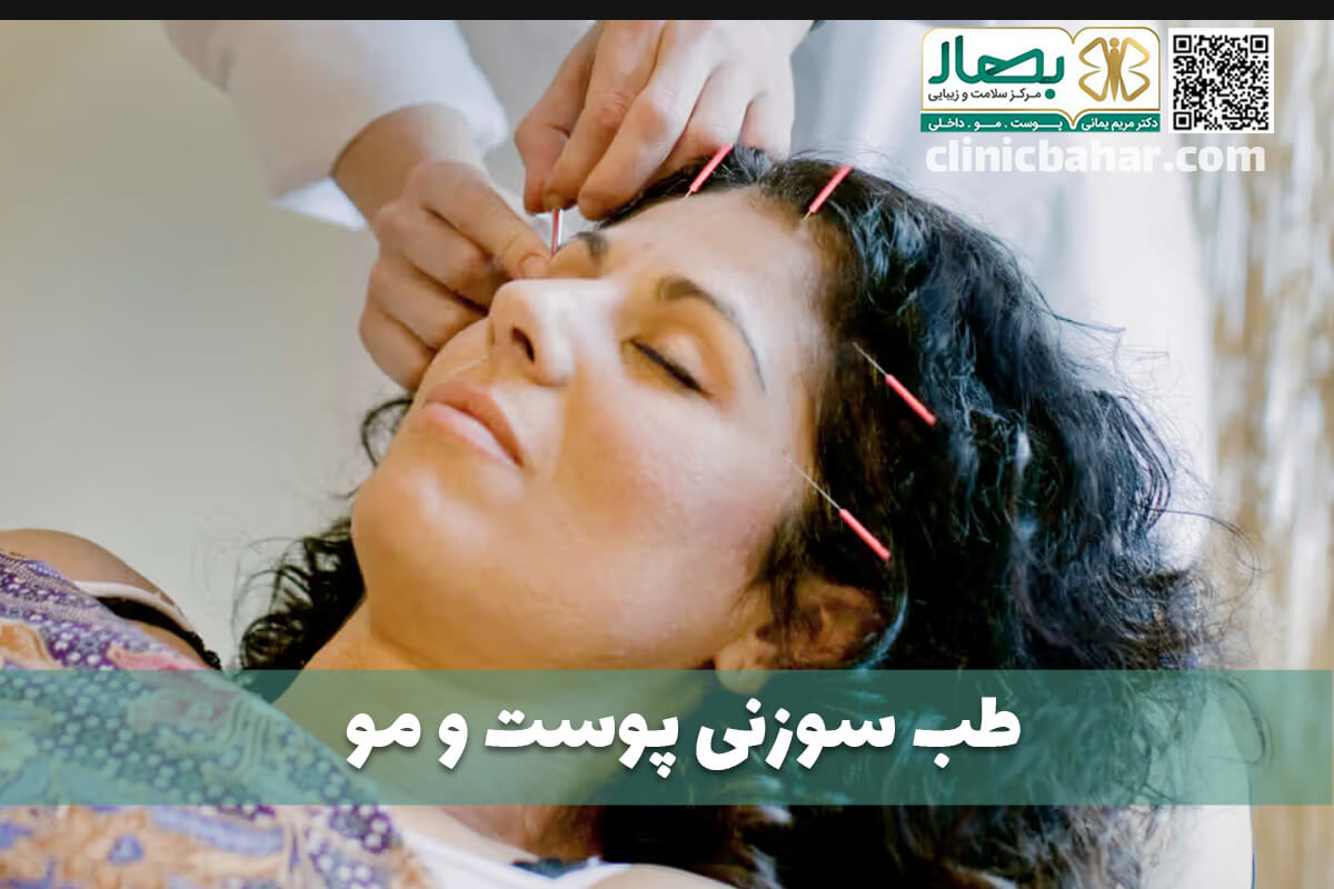 طب سوزنی پوست و مو - کلینیک بهار