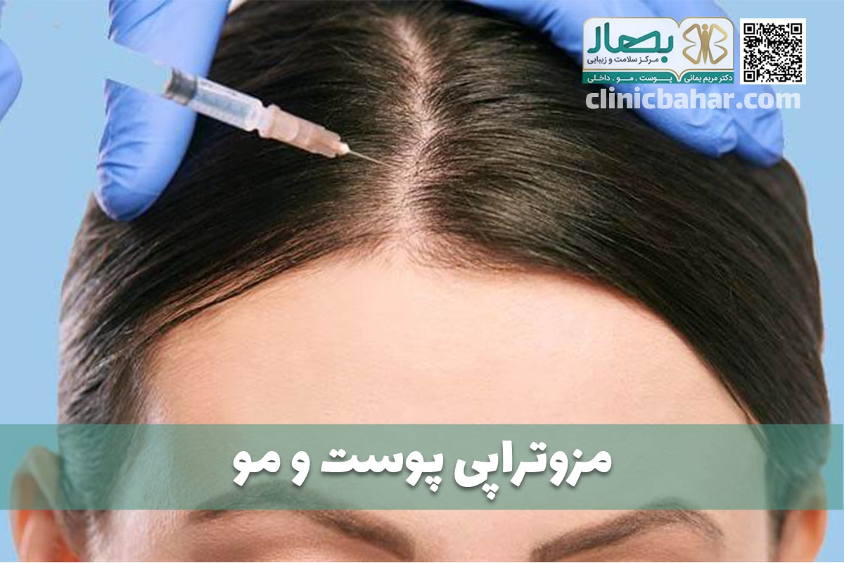 مزوتراپی پوست و مو